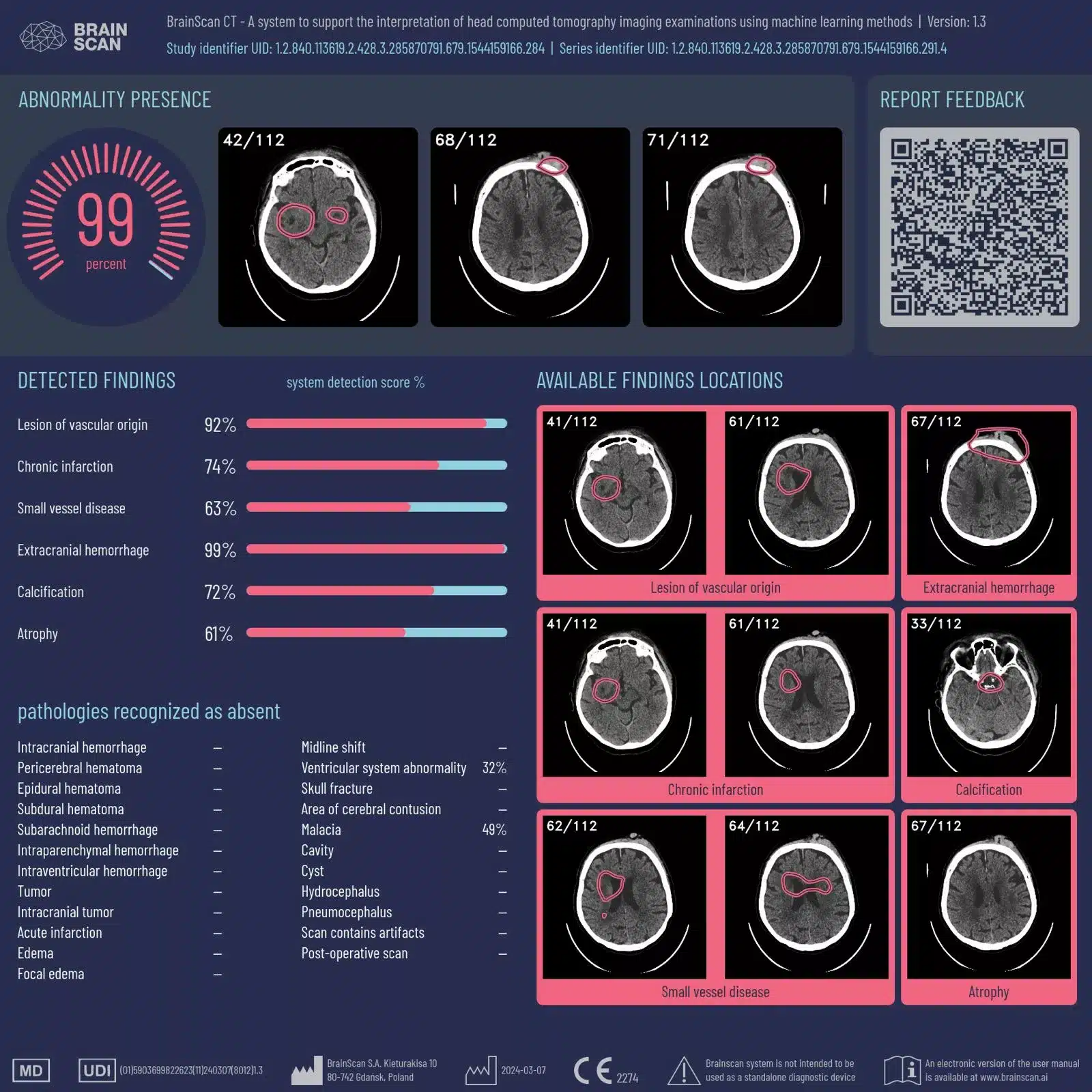 Wizualizacja Brainscan (1)